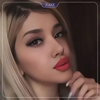 نمونه عمل جراحی بینی دکتر لیلا اسدپور — تصویر 3