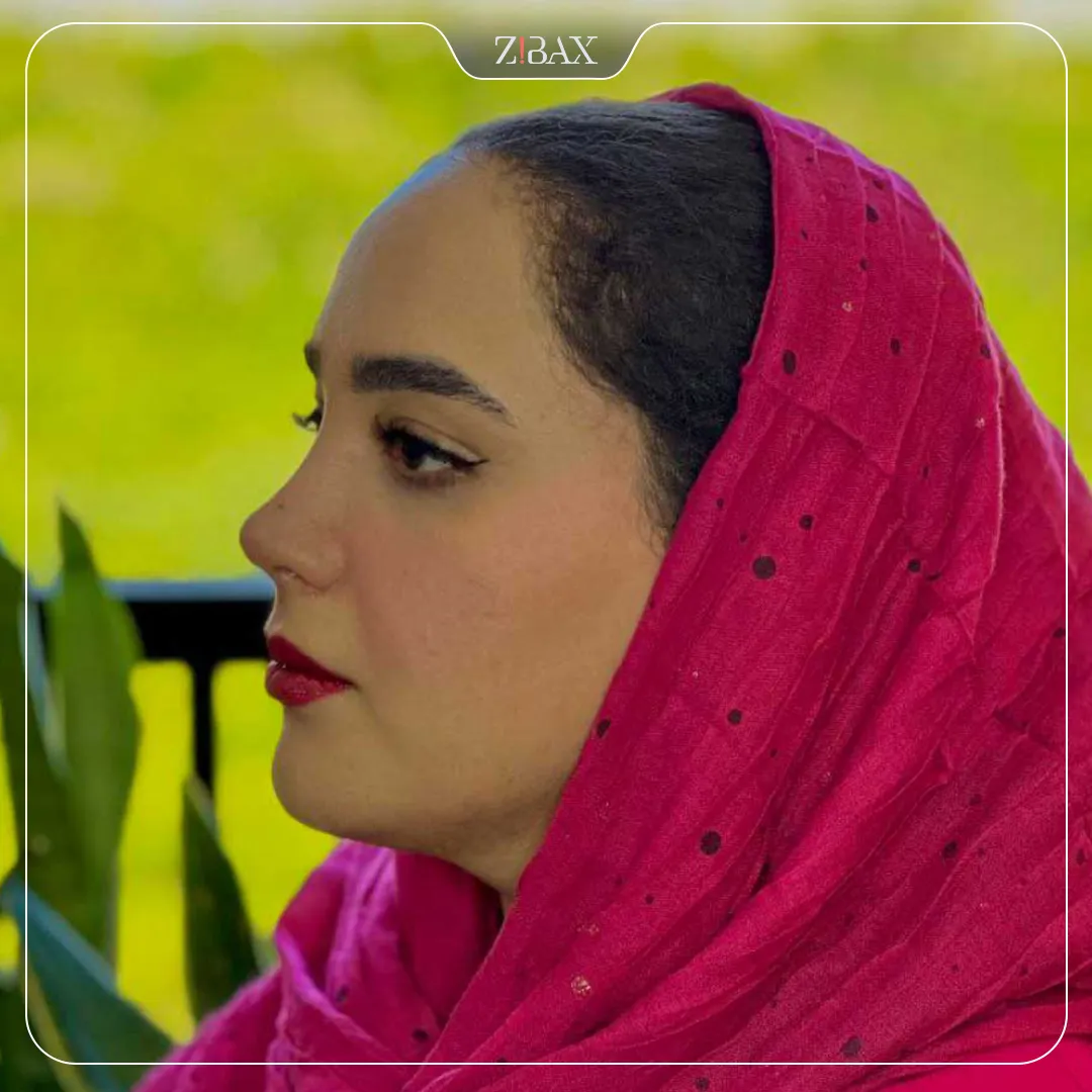 نمونه عمل جراحی بینی دکتر امید زرگرانی — تصویر 5