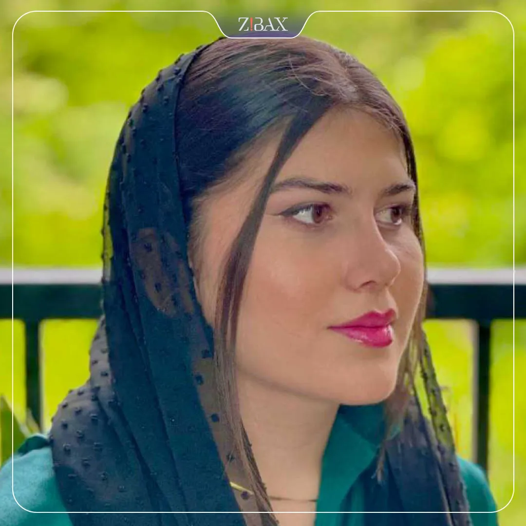 نمونه عمل جراحی بینی دکتر امید زرگرانی — تصویر 9