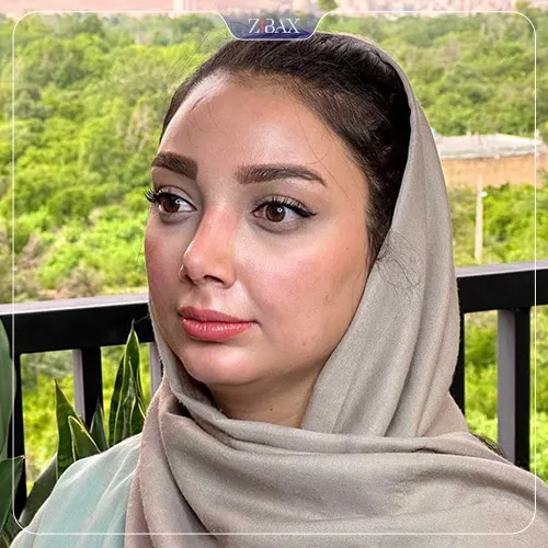 نمونه عمل جراحی بینی دکتر امید زرگرانی — تصویر 8