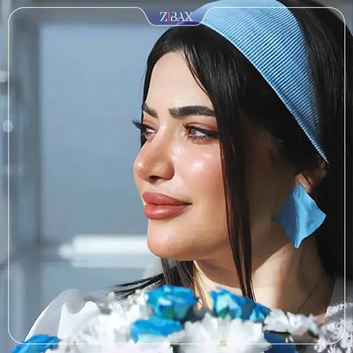 نمونه عمل جراحی بینی دکتر حسین مرادیان — تصویر 2