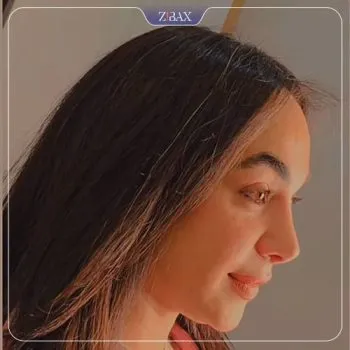 نتیجه جراحی