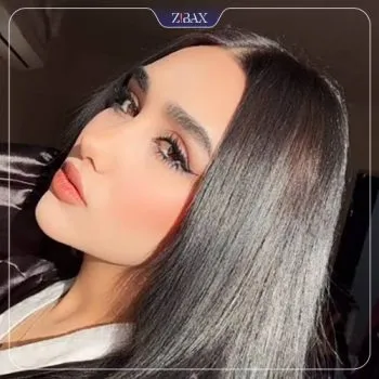 نمونه عمل جراحی بینی دکتر شهریار شاهمرادی — تصویر 4