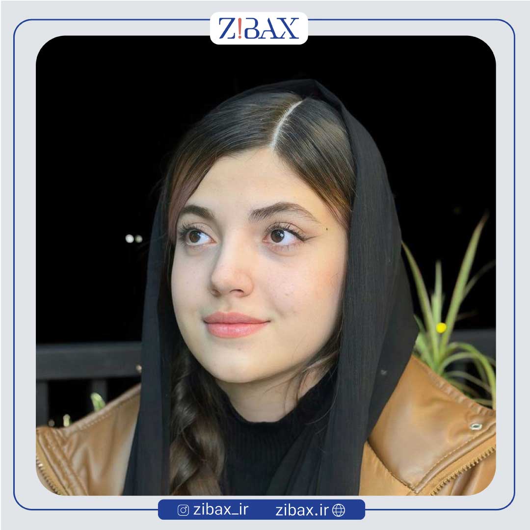 نمونه عمل جراحی بینی دکتر مسیح طالع جراح بینی شیراز — تصویر 10
