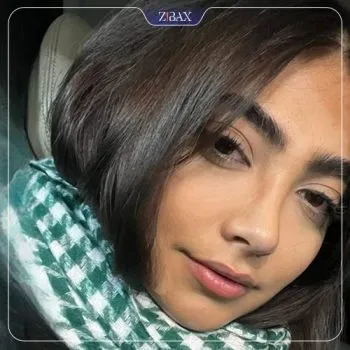 نمونه عمل جراحی بینی دکتر آرش سبحان منش — تصویر 9