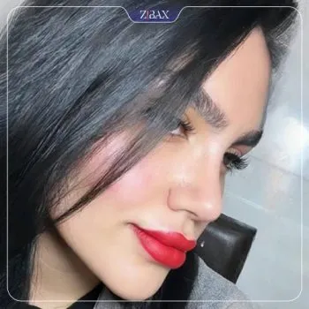 نمونه عمل جراحی بینی دکتر آرش سبحان منش — تصویر 4