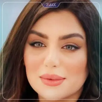نمونه عمل جراحی بینی دکتر سلمان شاکری — تصویر 5