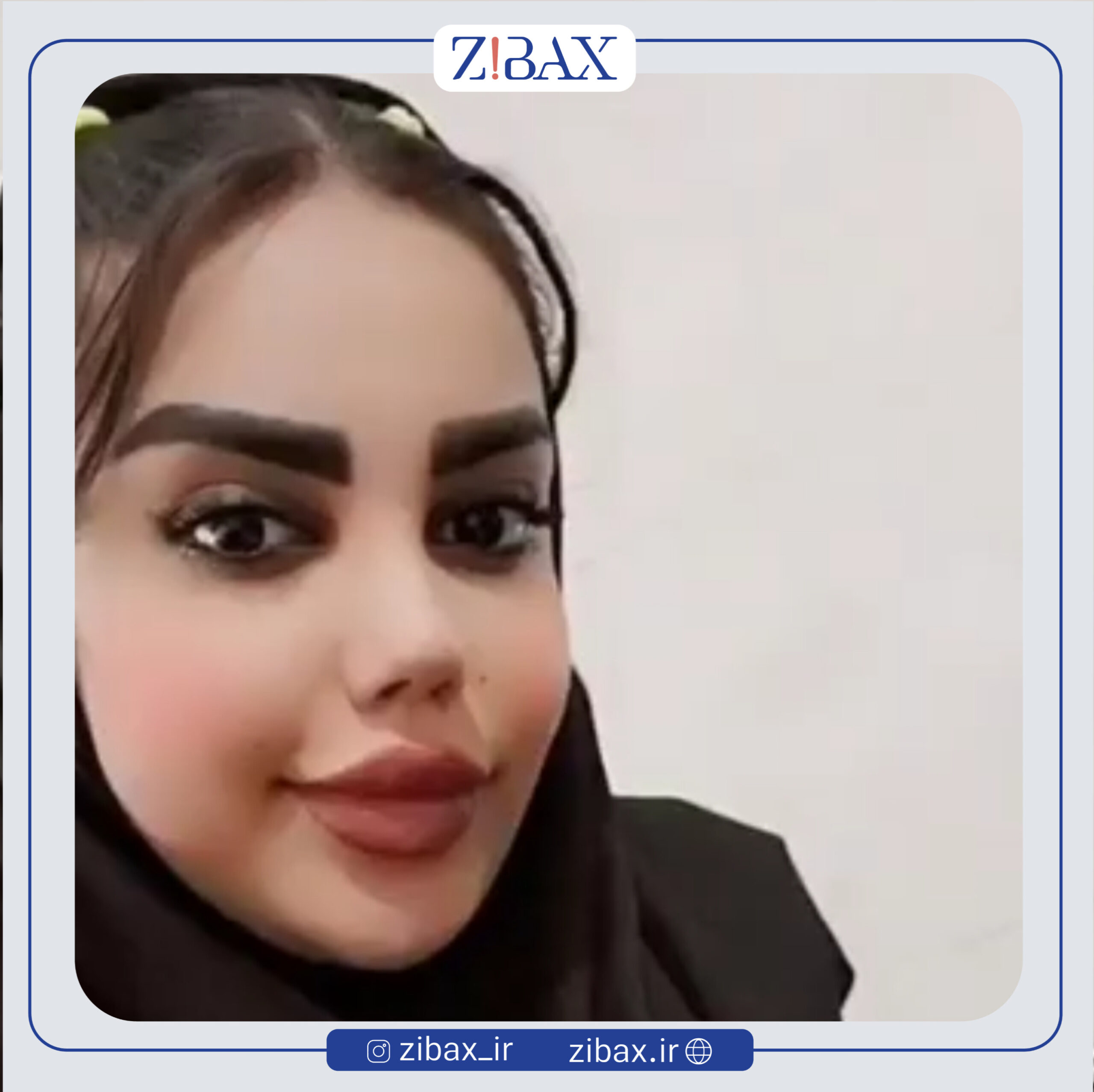 نتیجه جراحی