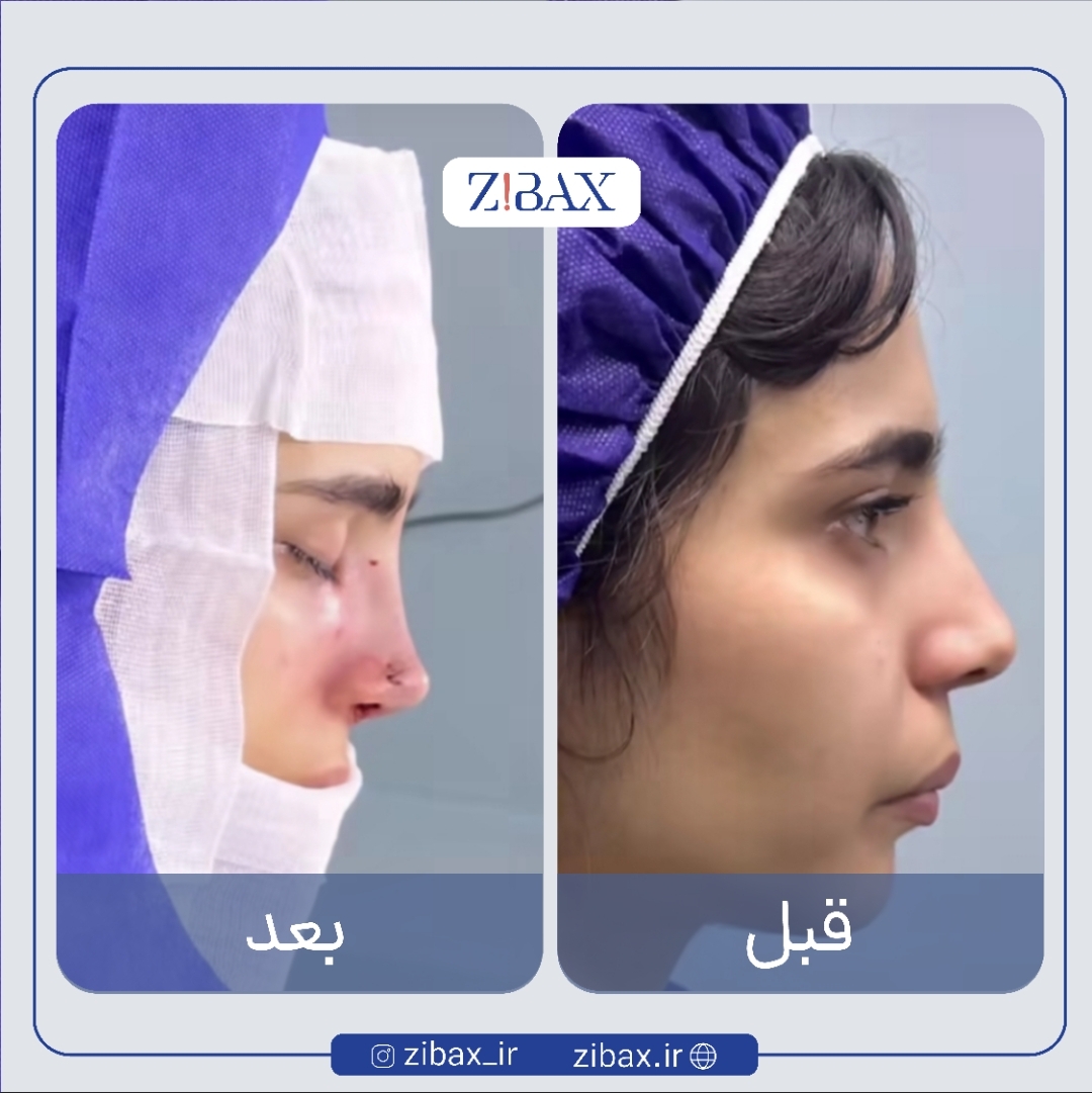 نتیجه جراحی
