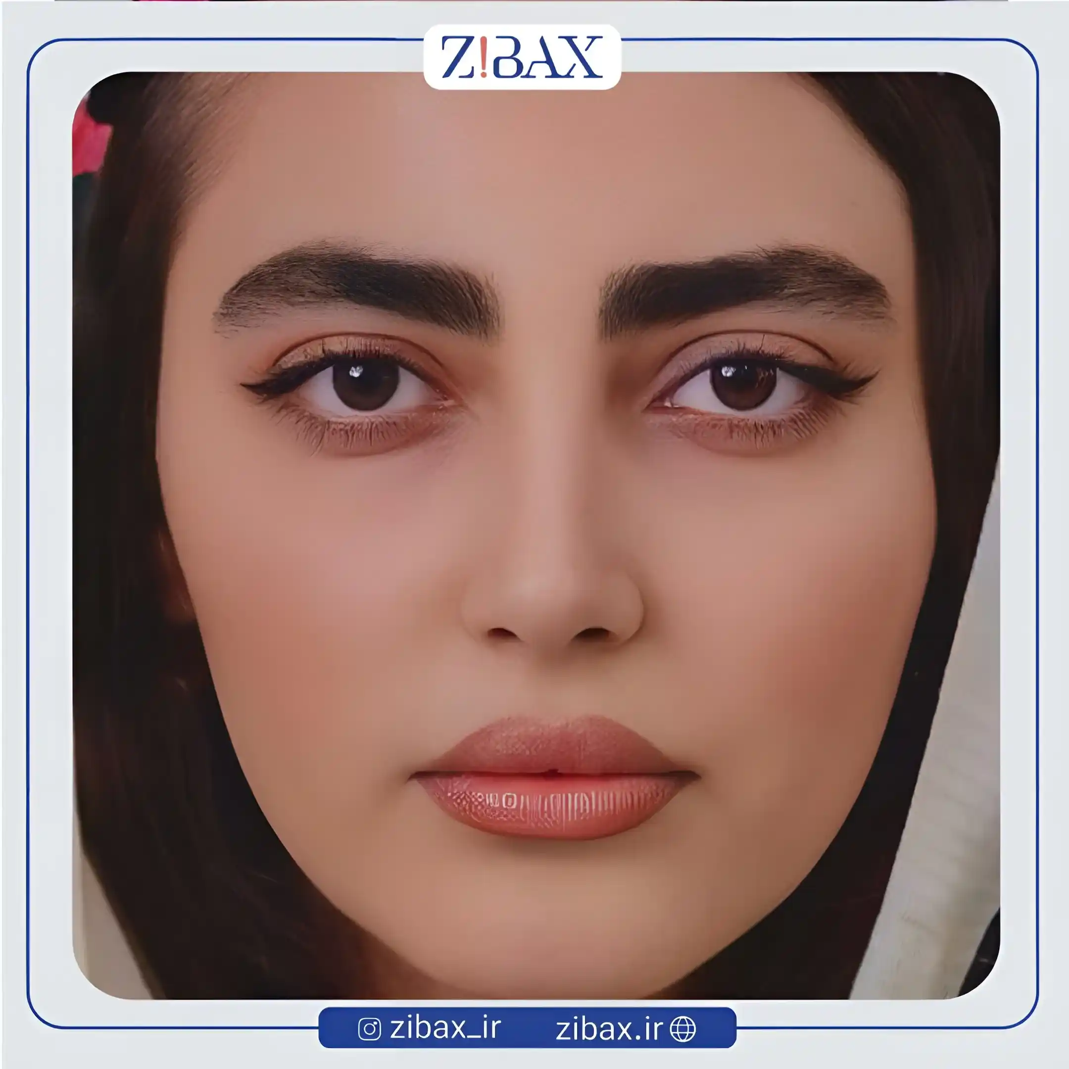 نمونه عمل جراحی بینی دکتر محسن بهادر — تصویر 2