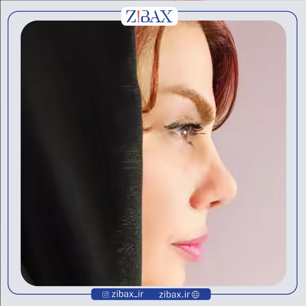 نمونه عمل جراحی بینی دکتر سیده نفیسه خلیلی — تصویر 3
