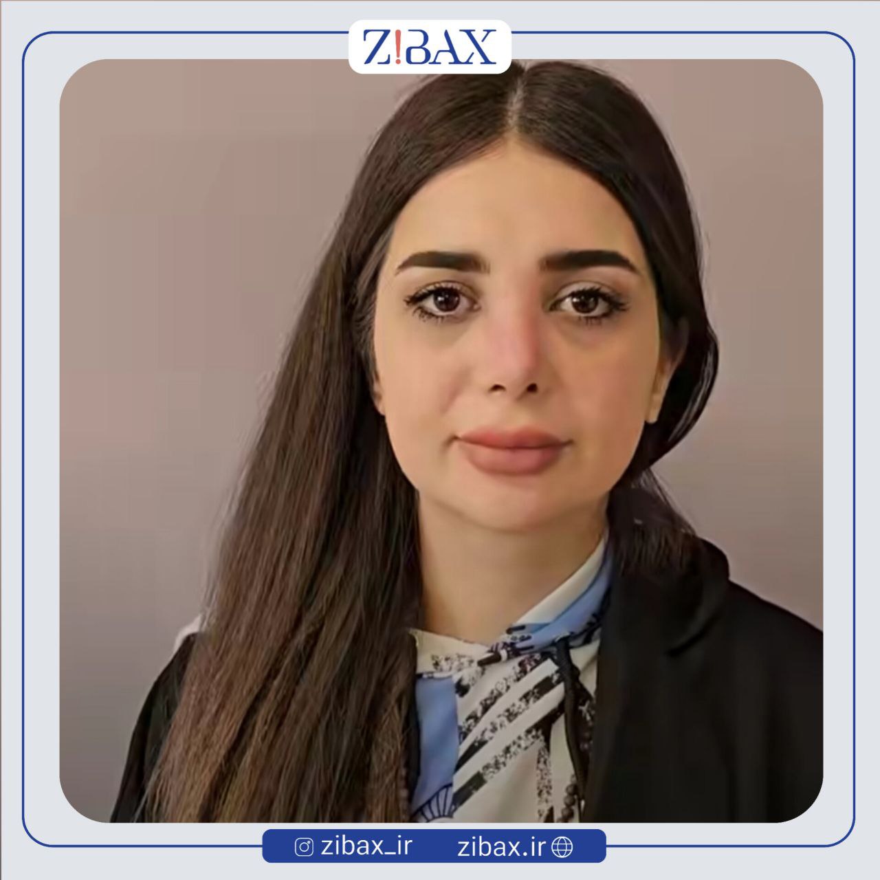 نمونه عمل جراحی بینی دکتر سیده نفیسه خلیلی — تصویر 5