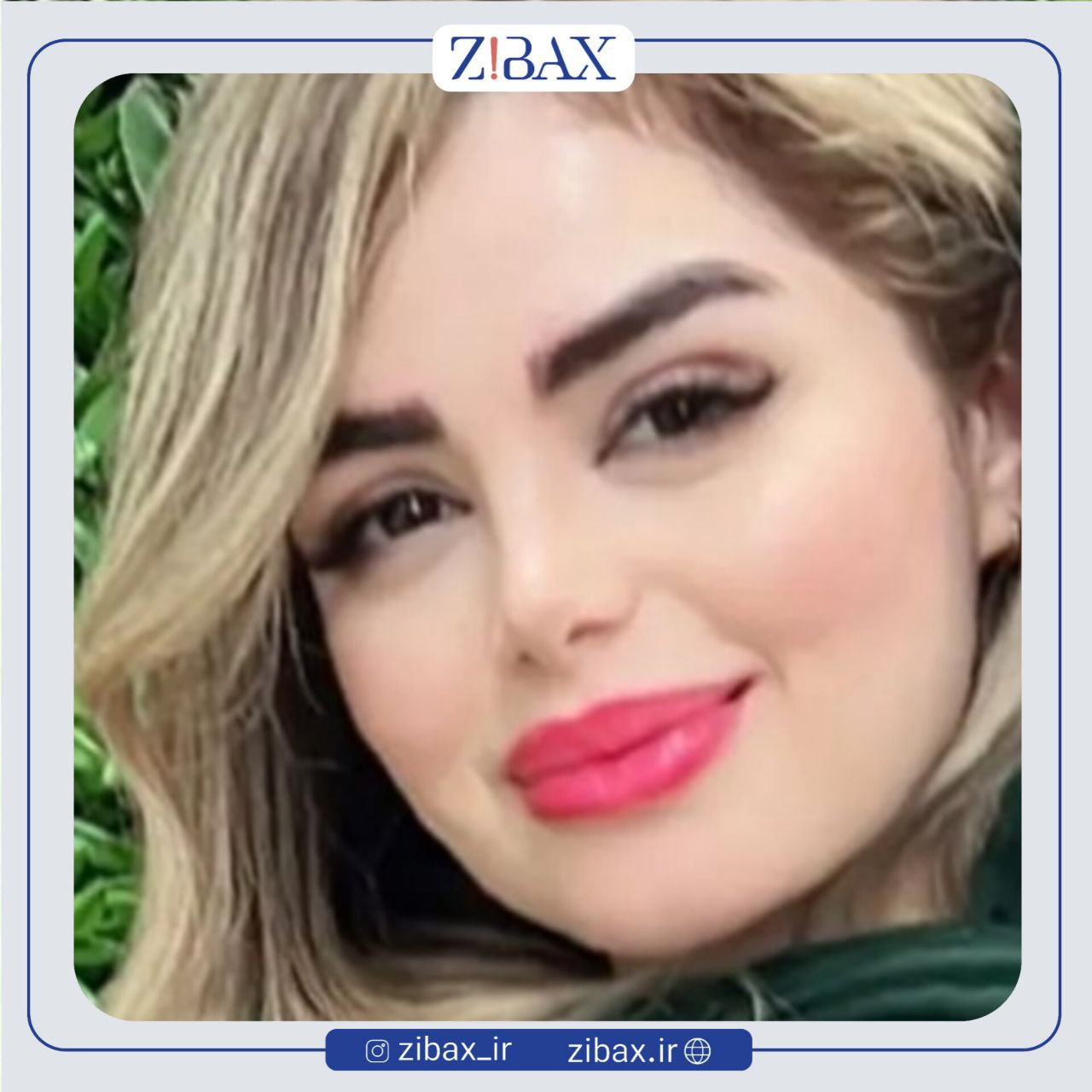 نمونه عمل جراحی بینی دکتر سیده نفیسه خلیلی — تصویر 7