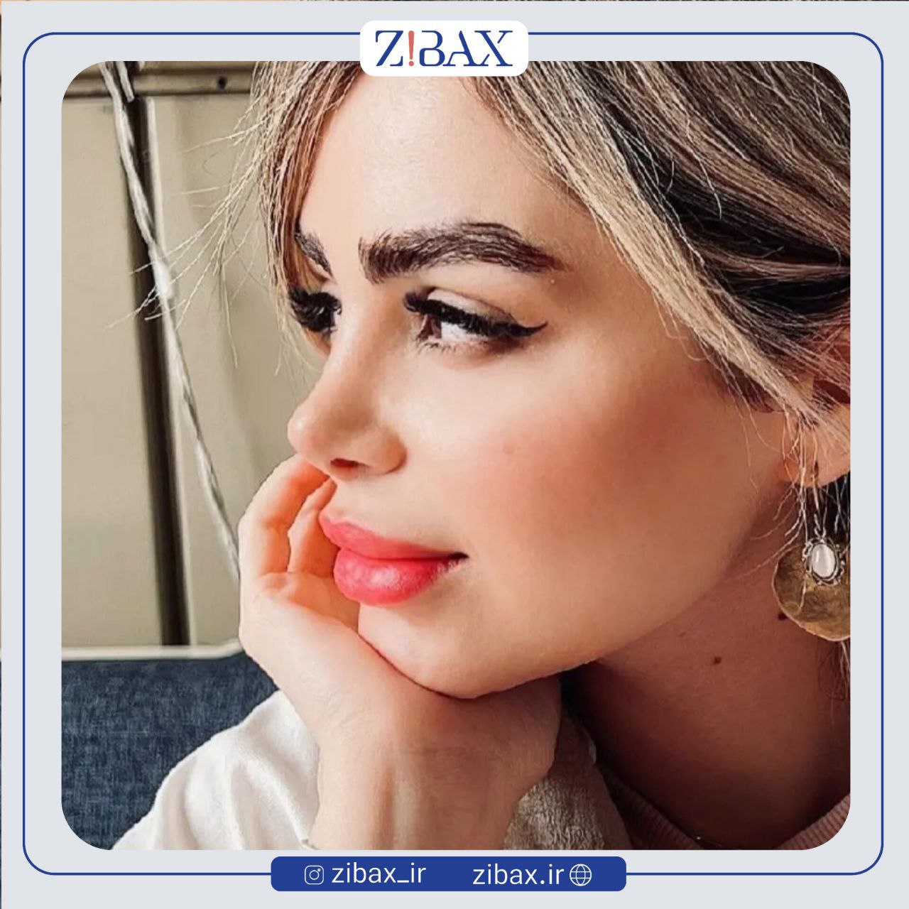 نمونه عمل جراحی بینی دکتر سیده نفیسه خلیلی — تصویر 9