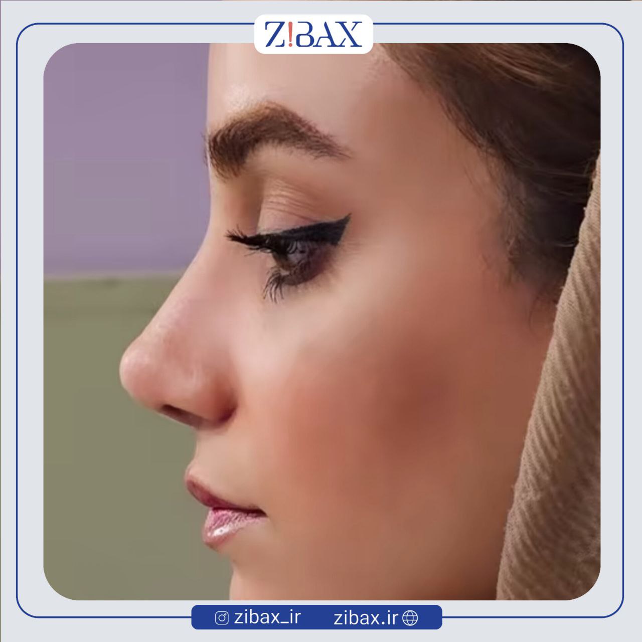 نمونه عمل جراحی بینی دکتر سیده نفیسه خلیلی — تصویر 10