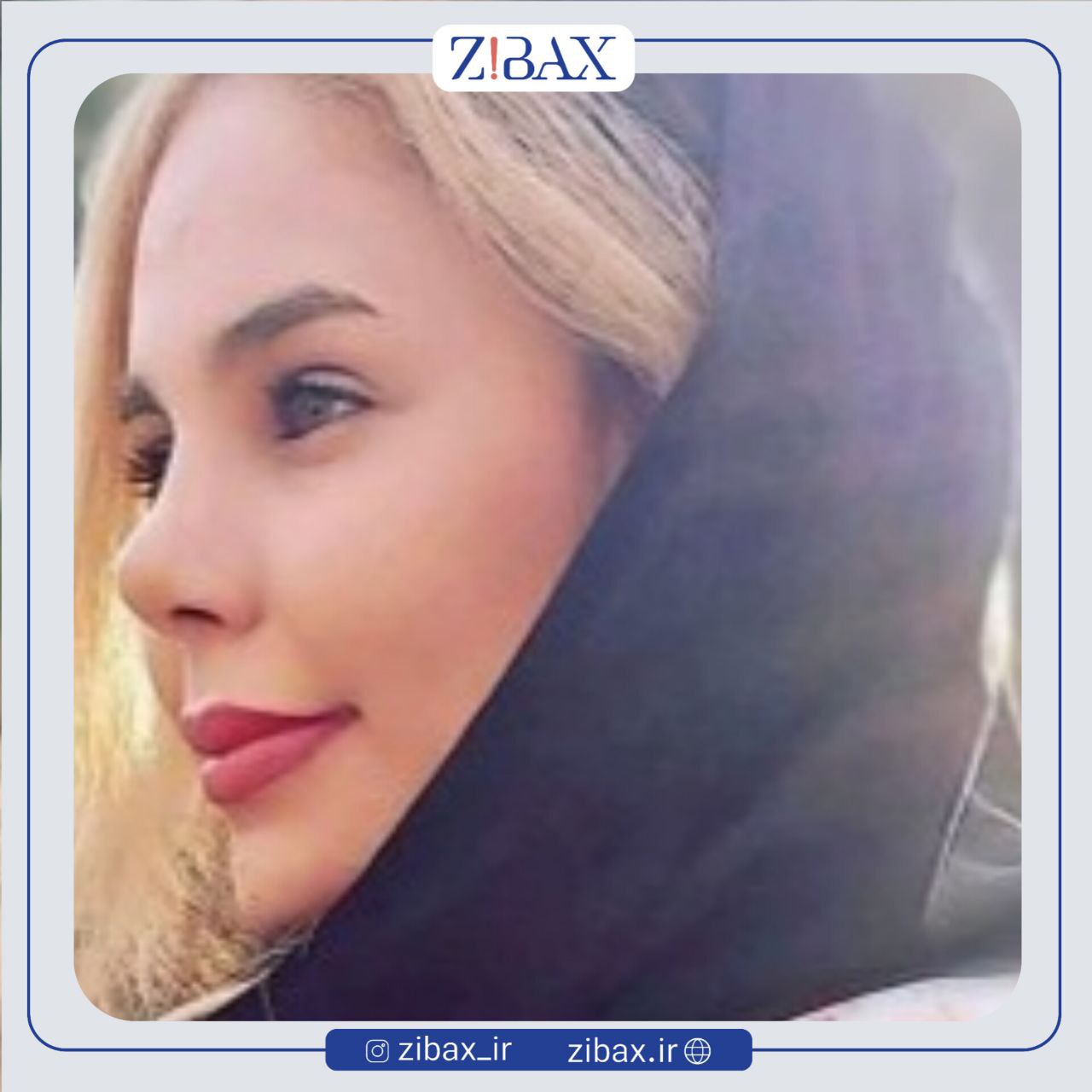 نمونه عمل جراحی بینی دکتر پریسا قاسمی — تصویر 1