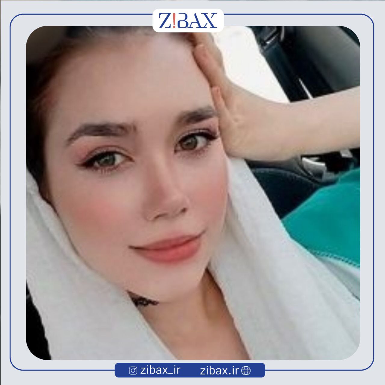 نمونه عمل جراحی بینی دکتر پریسا قاسمی — تصویر 10