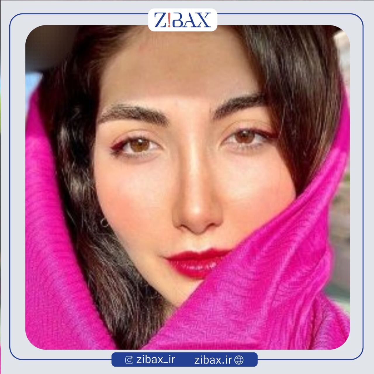 نمونه عمل جراحی بینی دکتر پریسا قاسمی — تصویر 7