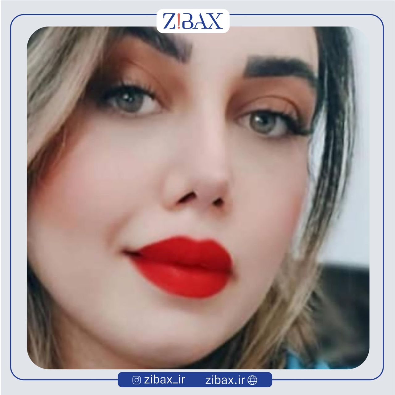 نمونه عمل جراحی بینی دکتر مرتضی جوادی — تصویر 2