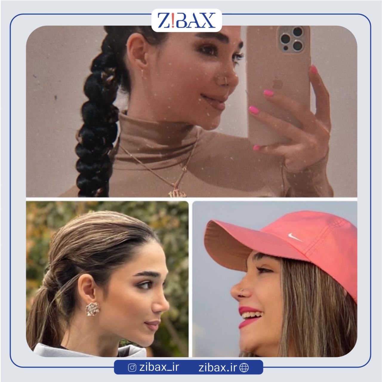 نمونه عمل جراحی بینی دکتر مرتضی جوادی — تصویر 4
