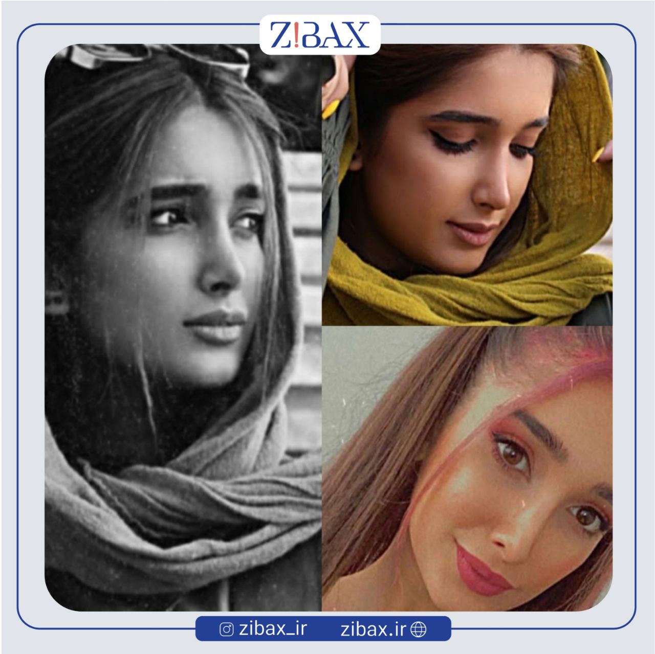 نمونه عمل جراحی بینی دکتر مرتضی جوادی — تصویر 5