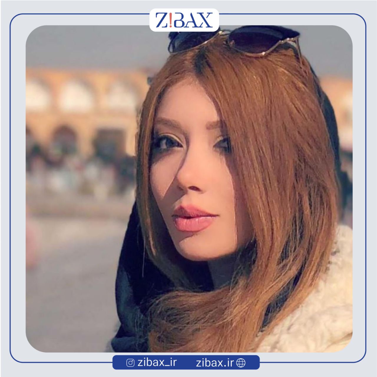 نمونه عمل جراحی بینی دکتر مرتضی جوادی — تصویر 7