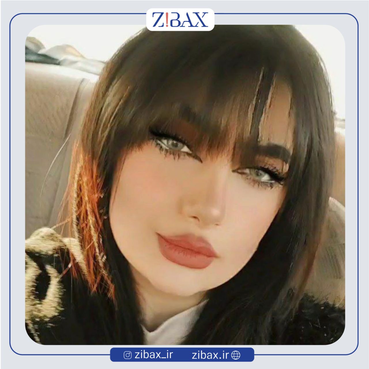 نمونه عمل جراحی بینی دکتر مرتضی جوادی — تصویر 8
