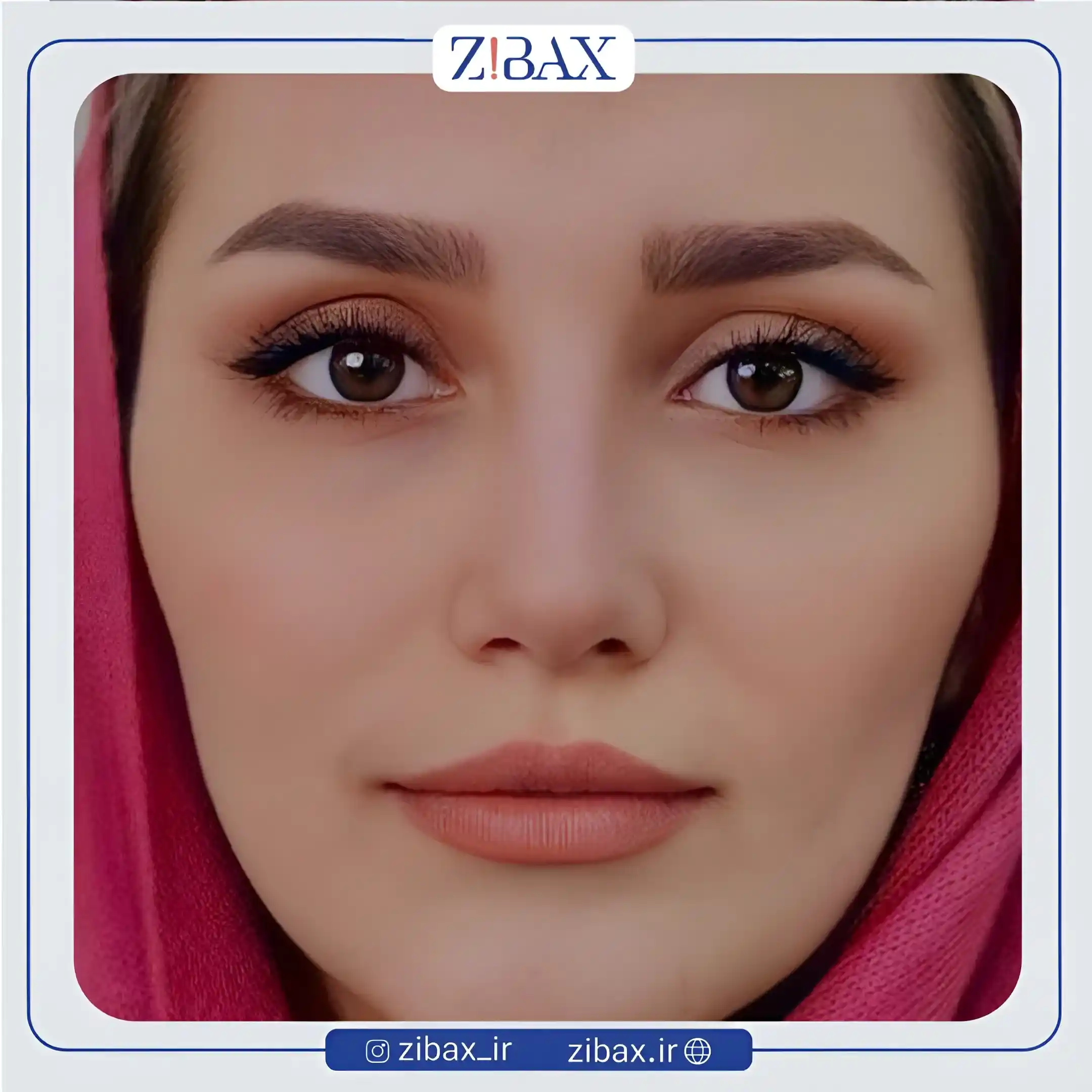نمونه عمل جراحی بینی دکتر محسن بهادر — تصویر 5