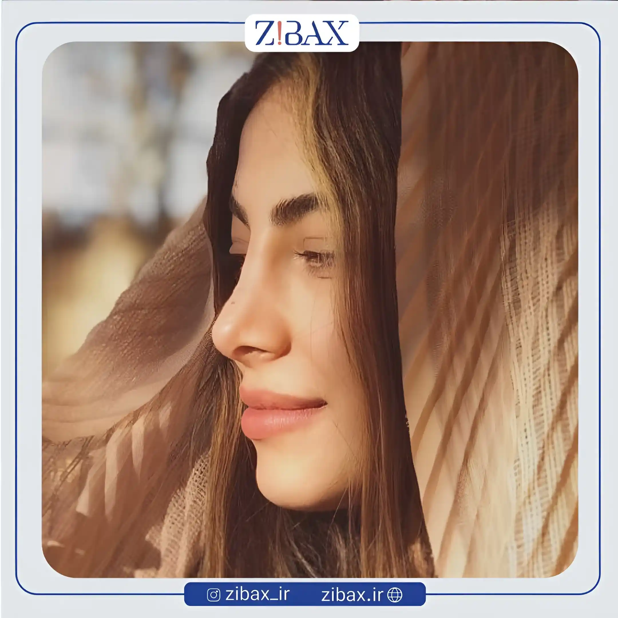 نمونه عمل جراحی بینی دکتر محسن بهادر — تصویر 7