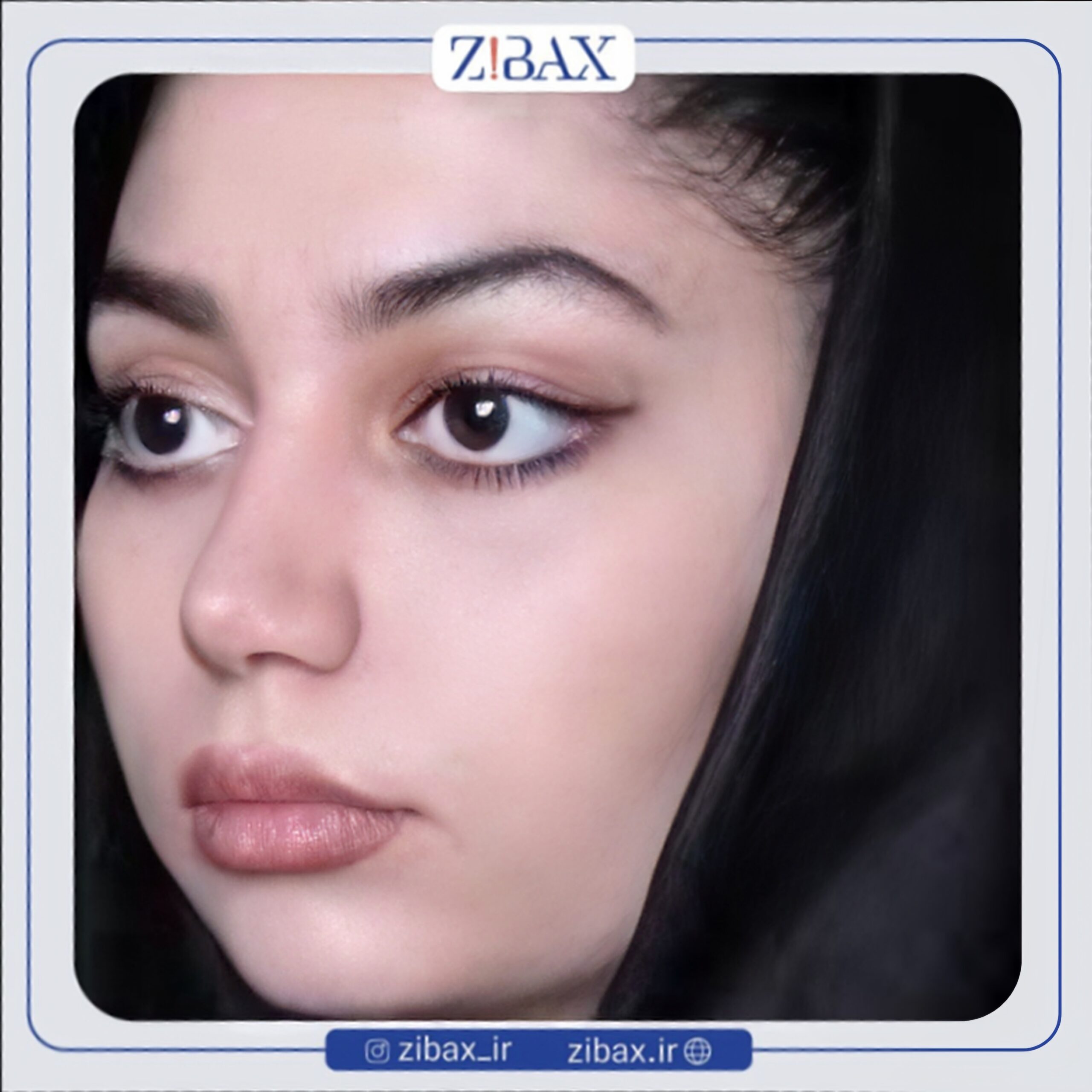 نمونه عمل جراحی بینی دکتر کیانا کیا — تصویر 10