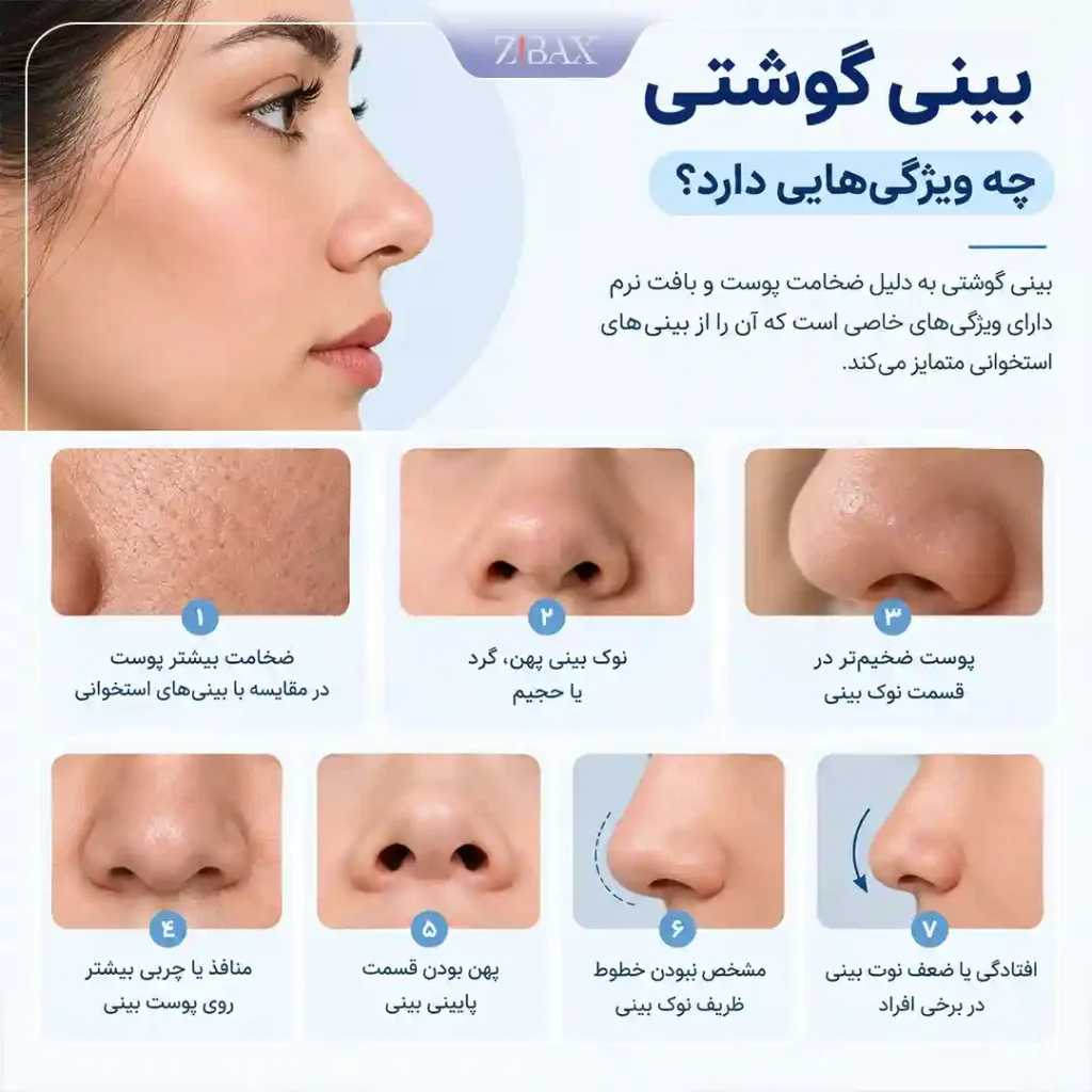 ویژگی های بینی بزرگ گوشتی