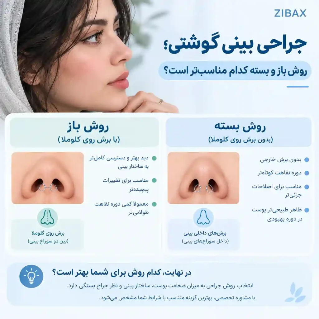 روش جدید عمل بینی گوشتی