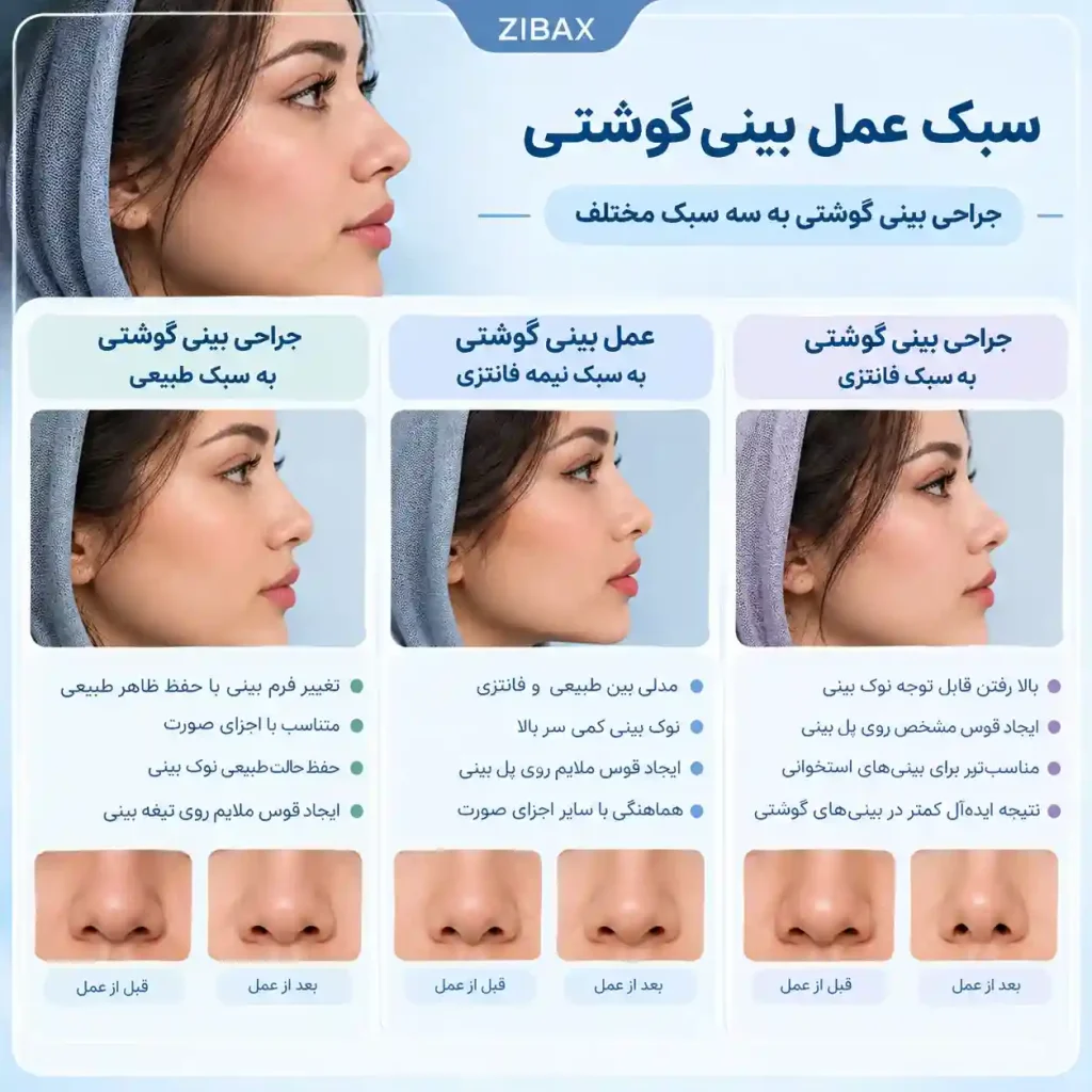 انواع عمل بینی گوشتی