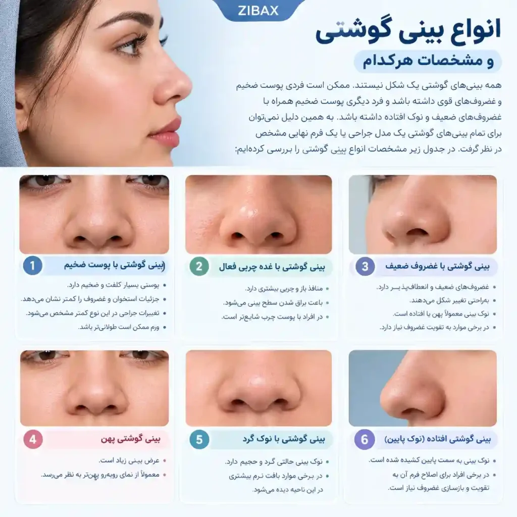 انواع بینی گوشتی