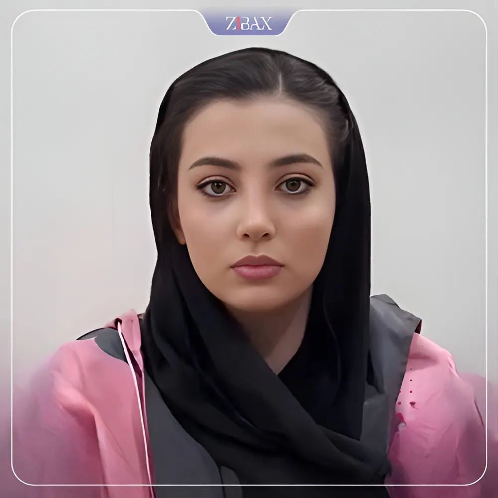 نمونه عمل جراحی بینی دکتر آرزو خوانساری نیا — تصویر 6