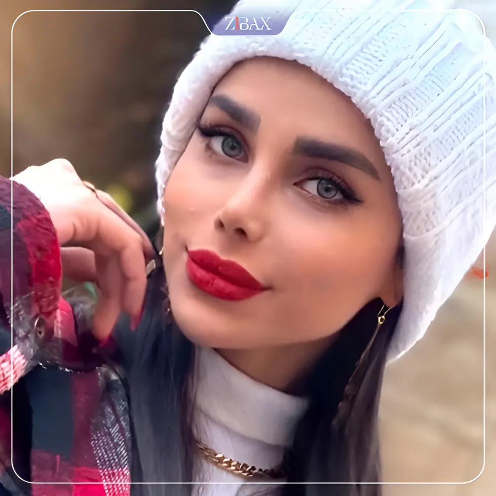 نمونه عمل جراحی بینی دکتر آرزو خوانساری نیا — تصویر 2