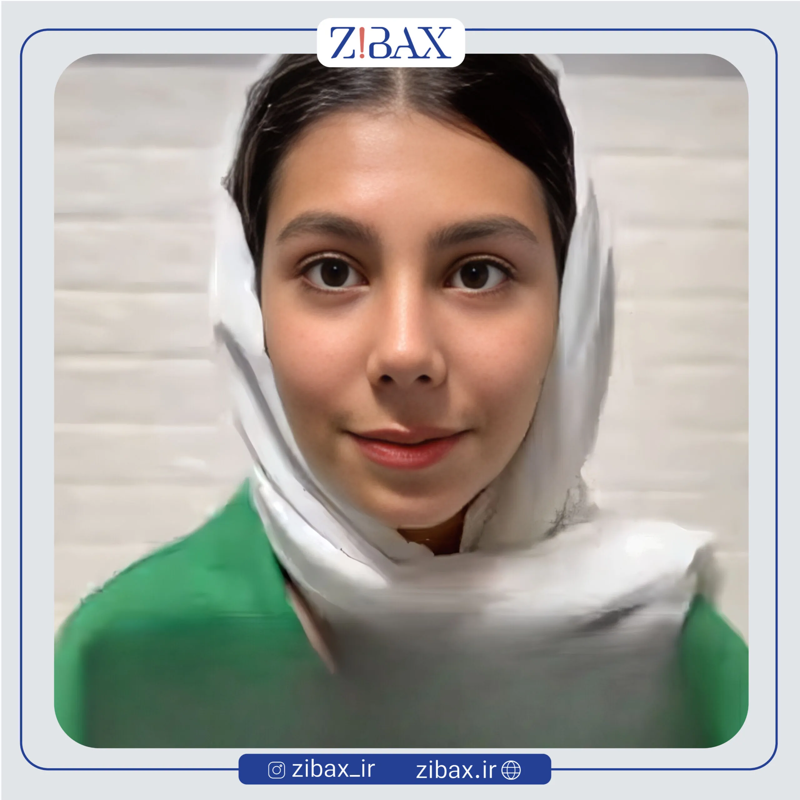 نمونه عمل جراحی بینی دکتر الهام کابلی — تصویر 2