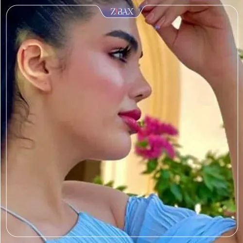 نمونه عمل جراحی بینی دکتر علی جاودانی — تصویر 4