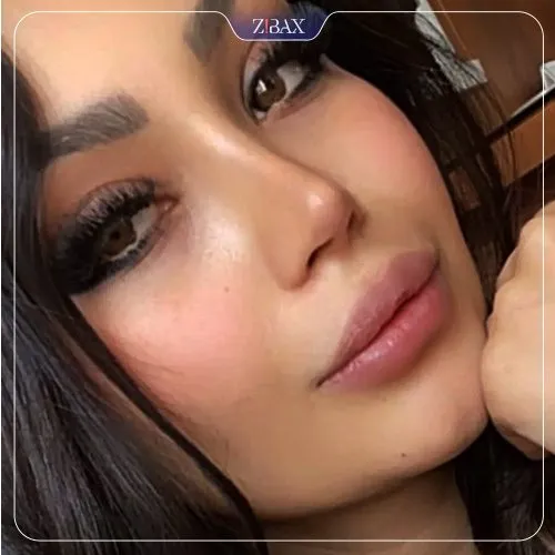 نمونه عمل جراحی بینی دکتر علی جاودانی — تصویر 7