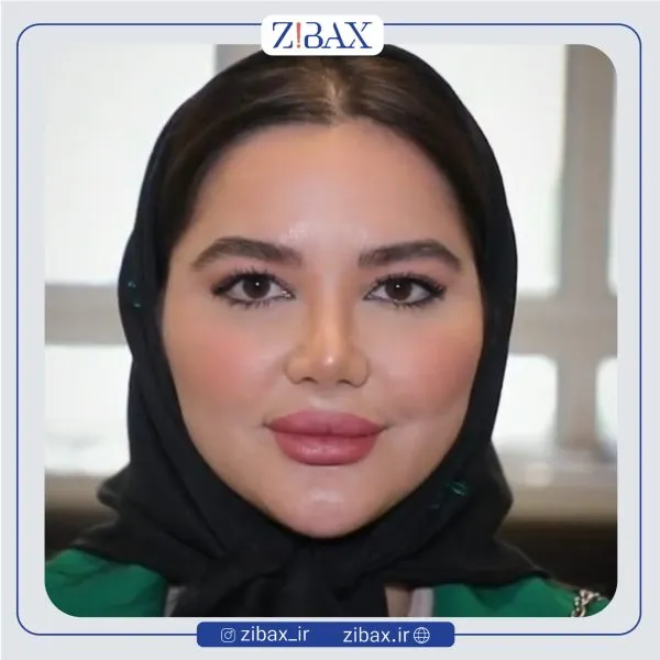 نمونه عمل جراحی بینی دکتر علیرضا عالیان — تصویر 3