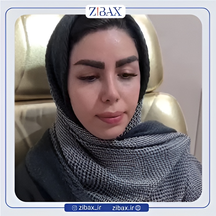 نمونه عمل جراحی بینی دکتر عطاالله غفاری — تصویر 4