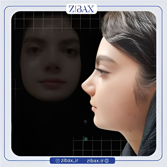 نمونه عمل جراحی بینی دکتر عطاالله غفاری — تصویر 5