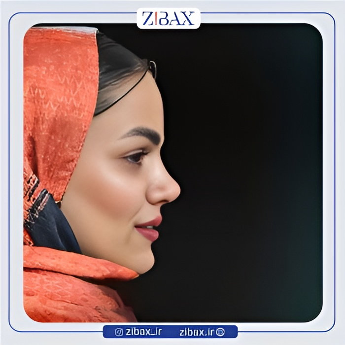 نمونه عمل جراحی بینی دکتر عطاالله غفاری — تصویر 1