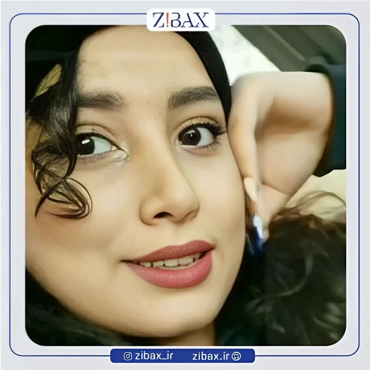 نمونه عمل جراحی بینی دکتر مجید جلالی — تصویر 10