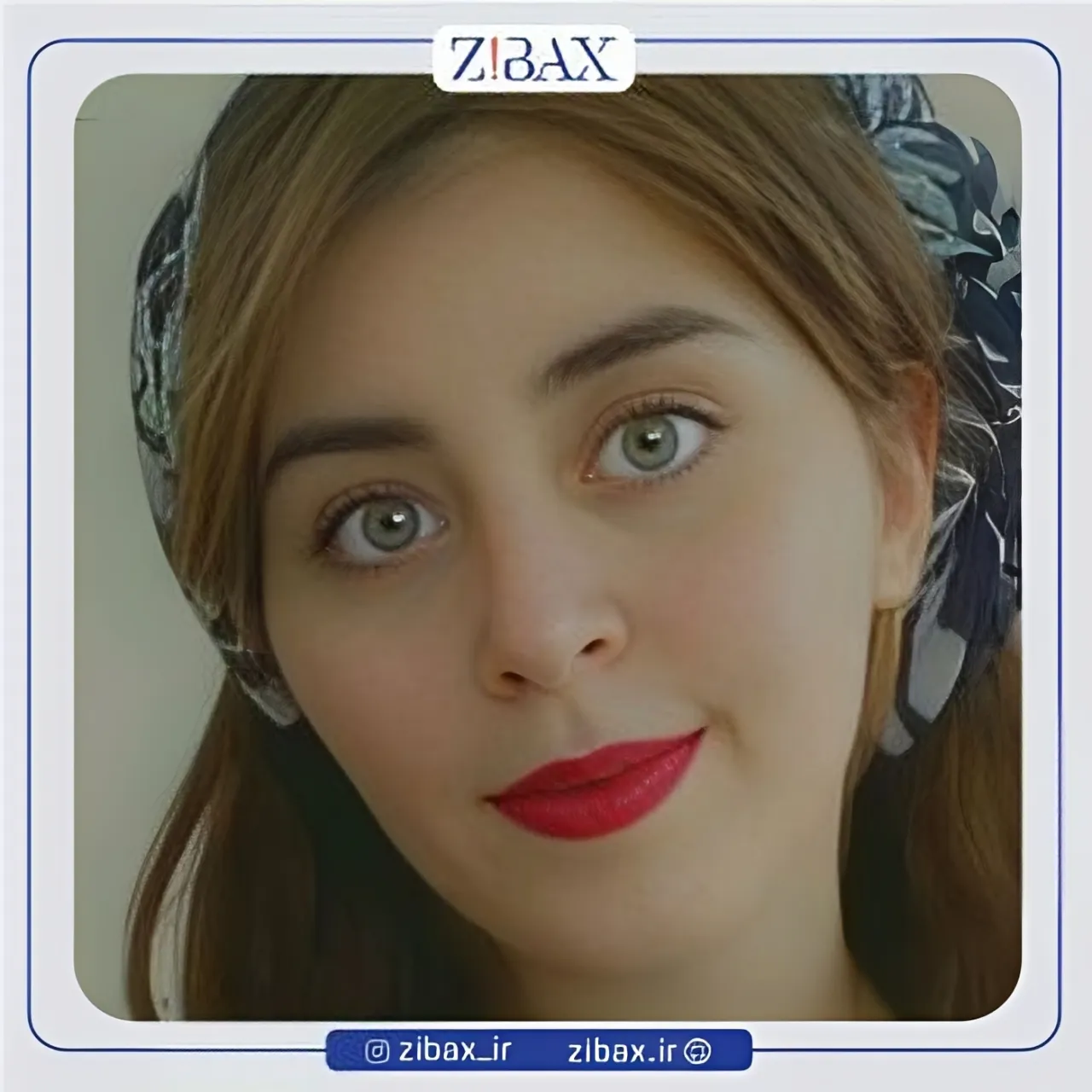 نمونه عمل جراحی بینی دکتر مجید جلالی — تصویر 1