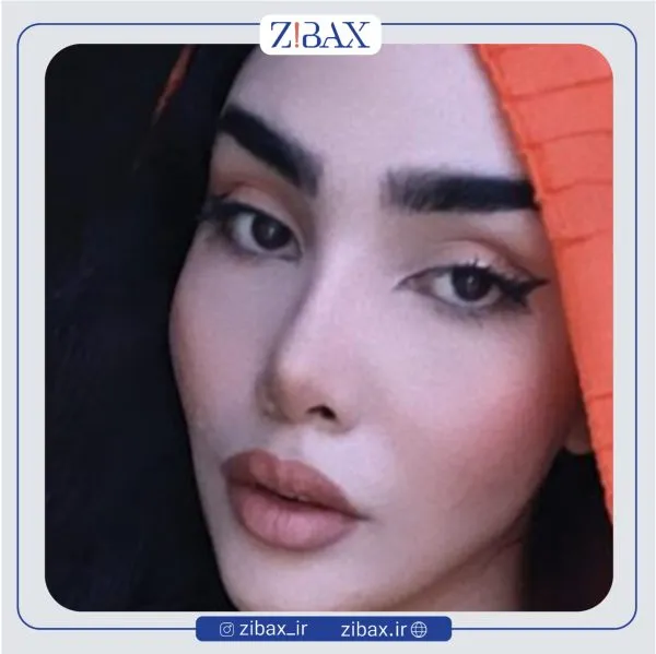نمونه عمل جراحی بینی دکتر مهدی صباغی — تصویر 5