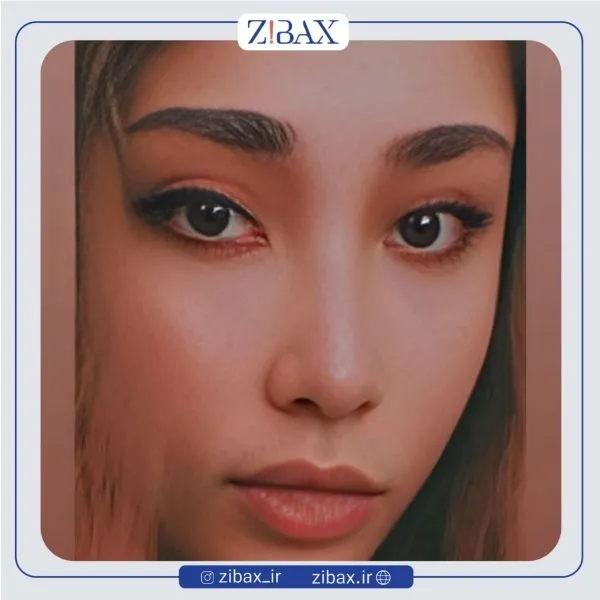 نمونه عمل جراحی بینی دکتر پوپک ایزدی — تصویر 10
