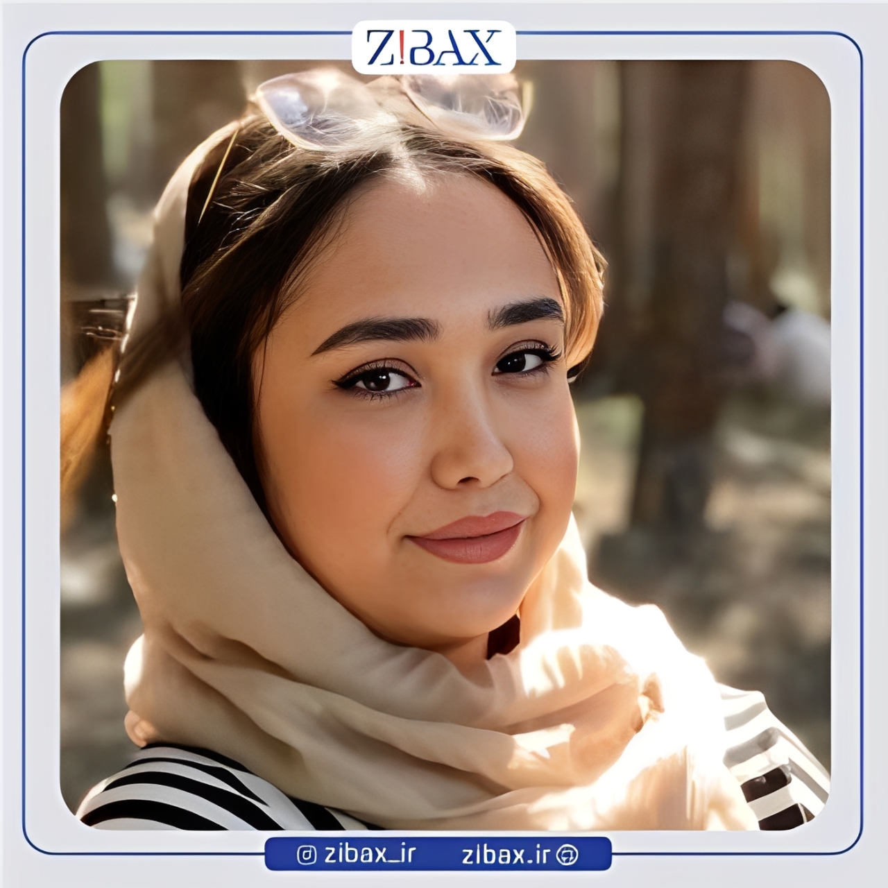 نمونه عمل جراحی بینی دکتر رضا چایچیان — تصویر 7