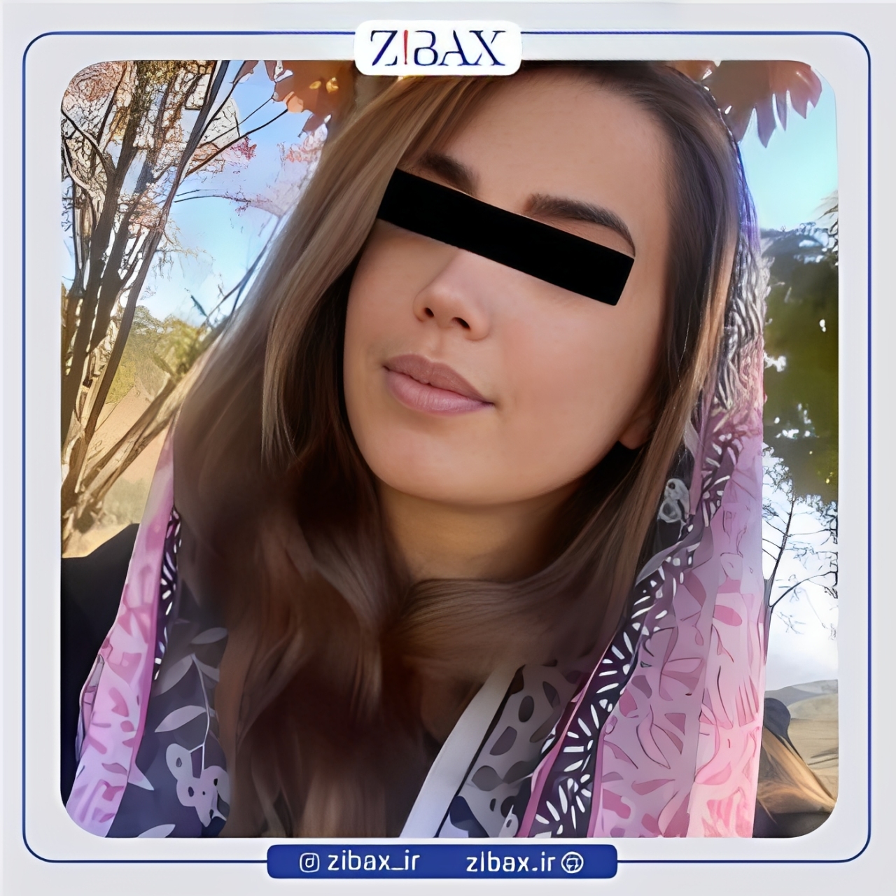 نمونه عمل جراحی بینی دکتر رضا چایچیان — تصویر 1
