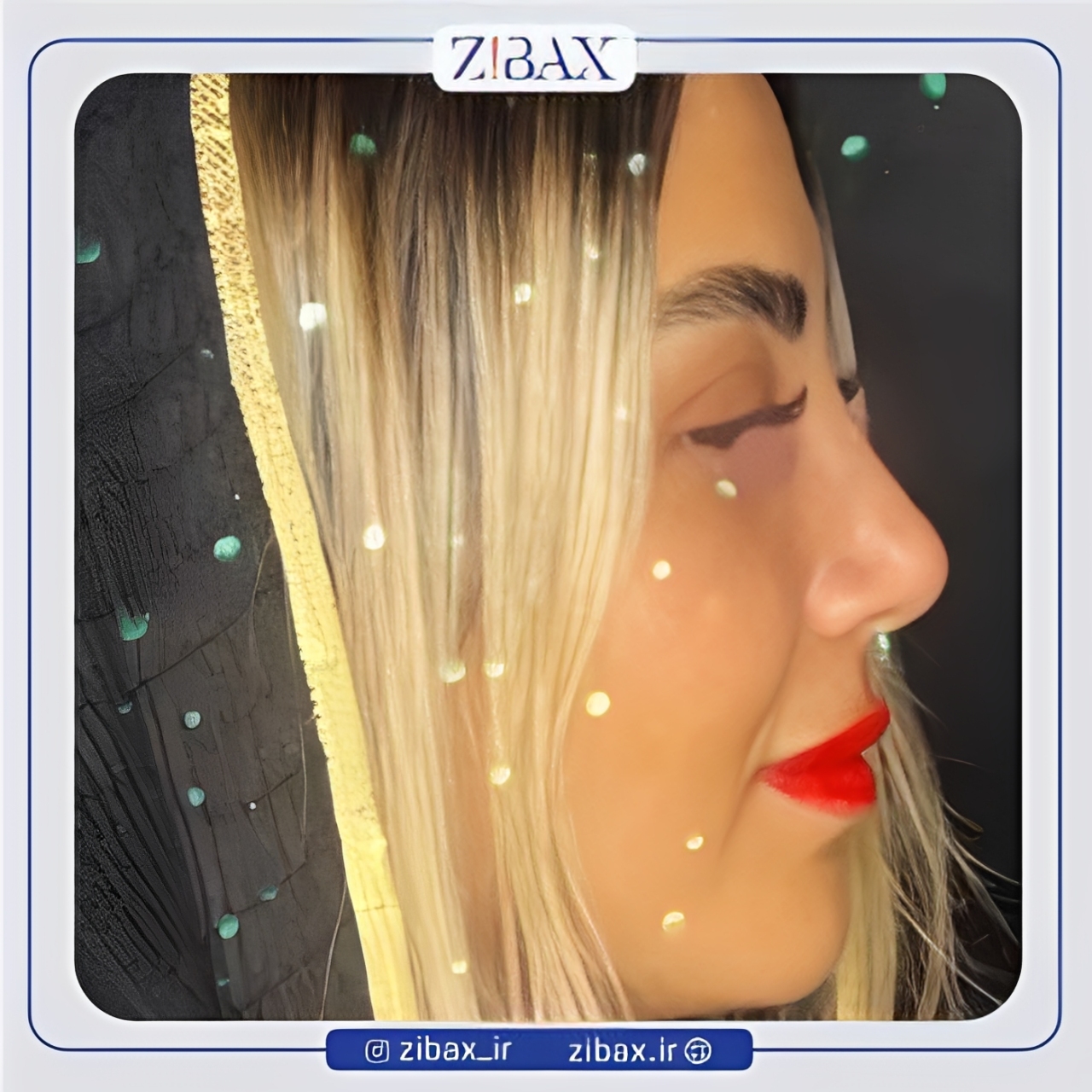نمونه عمل جراحی بینی دکتر رضا چایچیان — تصویر 2